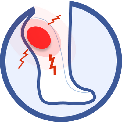 Plantar Fasciitis