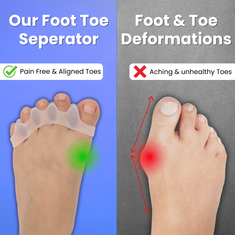 Toe Spacer Set for Toe Alignment and Everyday Foot Comfort